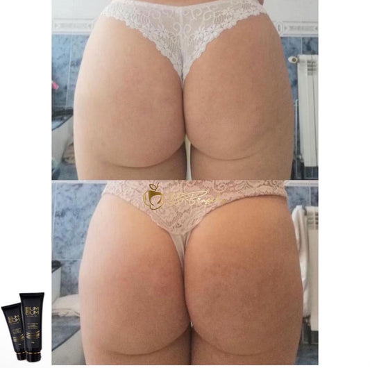 Surreal esse resultado do nosso creme Bumbum Brasil180