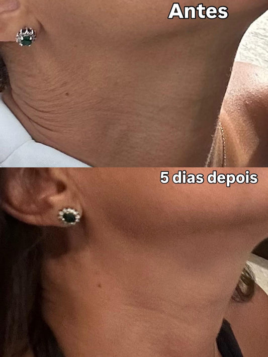 Fiquei chocada com o resultado da minha nuca! 😱💛